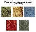 brocart histo.webp